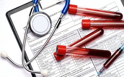 Billing Codes for Monoclonal Antibody COVID-19 Infusion